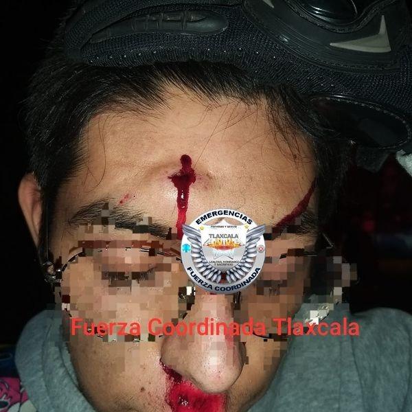 Aparatoso choque de una motocicleta en la lateral de la carretera  Tlaxcala-Apizaco