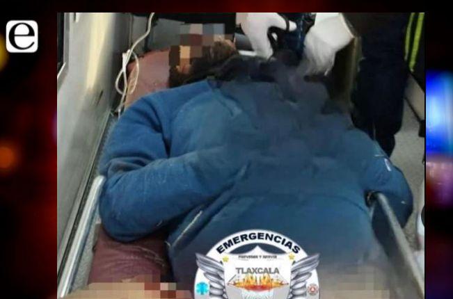 Otro baleado ahora en Apizaco 