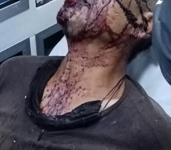 Lo asaltan y aparte recibe tremenda golpiza que lo manda al hospital