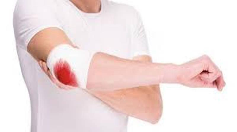 Exhorta IMSS Tlaxcala a conocer más sobre la hemofilia para una atención oportuna