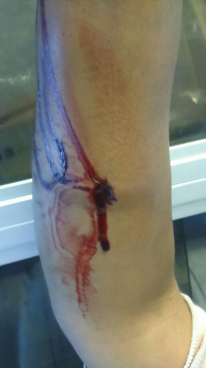 Deja individuo lesionada a su cónyuge de un balazo