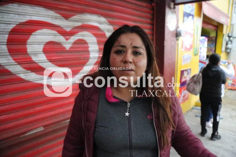 Denuncian agresión de un presunto trabajador de la UATx