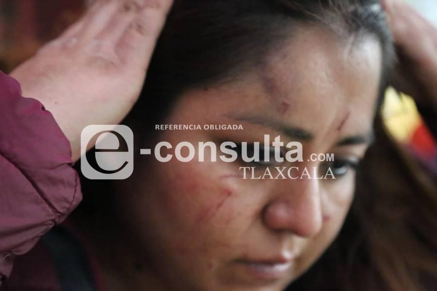 Denuncian agresión de un presunto trabajador de la UATx