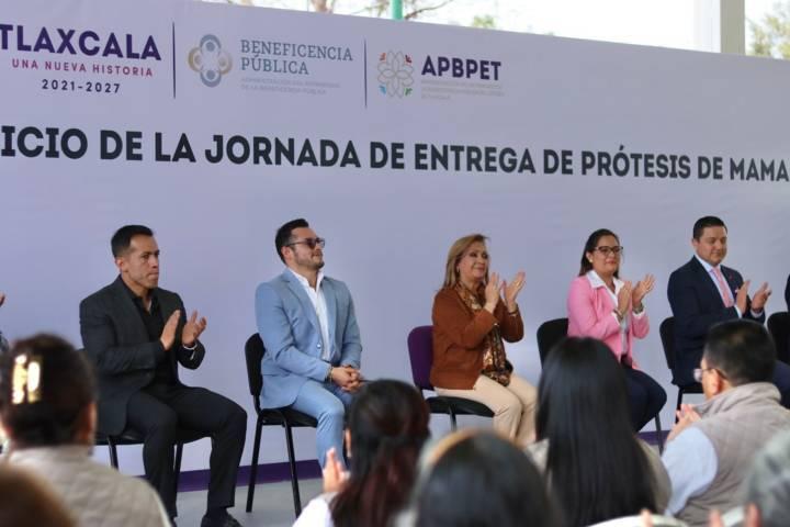 Inicio de la jornada de entrega de prótesis de mama 