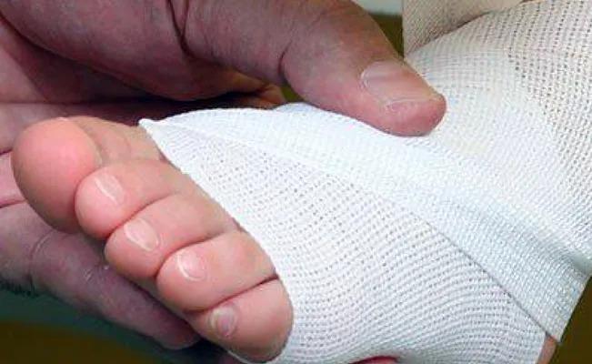 Por una caminadora, un niño sufre lesión en el tobillo y muere a causa de una bacteria carnívora