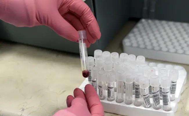 Por un trasplante de células, tres pacientes se curan de VIH